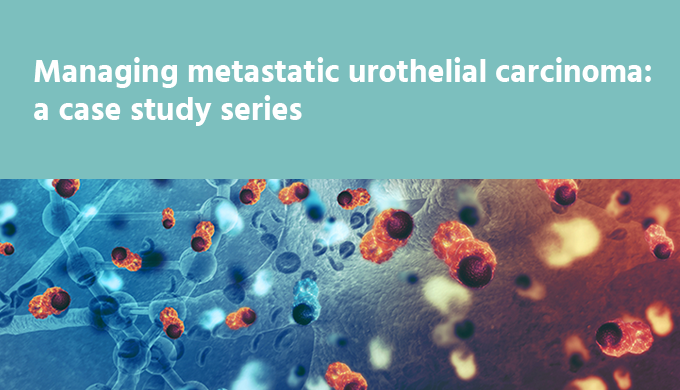 Urothelial Cancer_Case_banner_680x390_IME_Homepage_20211011_2