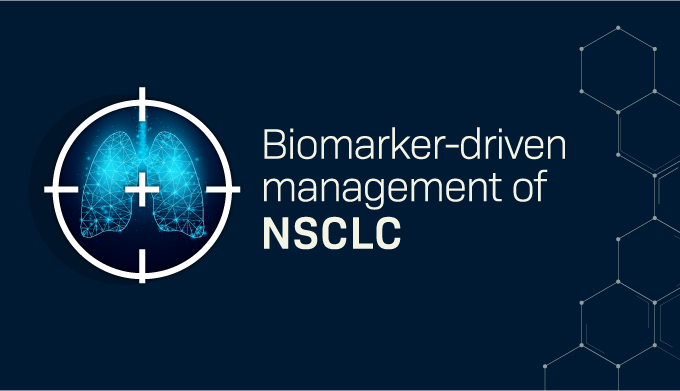 BiomarkerNSCLC_IME box_web (2)